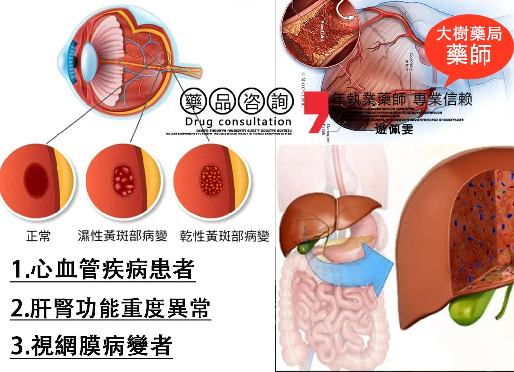 雙效艾力達Super Levifil完整指南：真偽辨識、安全服用與副作用處理